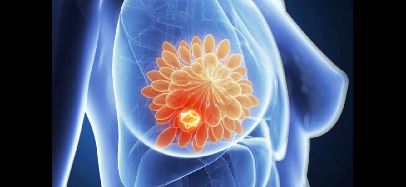 Promising breakthrough in breast cancer treatment eliminates dormant cells.
