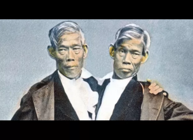 Conjoined twins with combined 21 offspring.