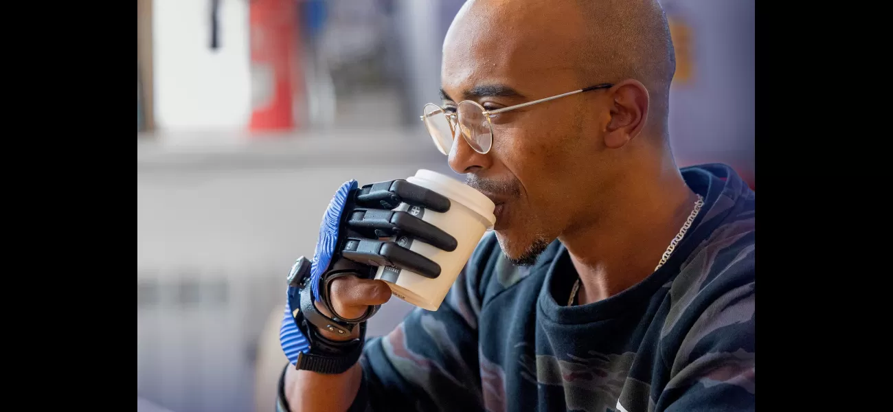 A man injured by a meat grinder receives new bionic fingers made with a 3D printer.