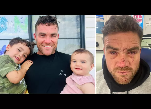 A man who was attacked and lost an eye by a stranger says he has come to terms with it.