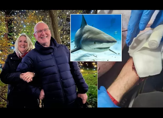 UK tourist recovering after shark attack results in loss of limb.