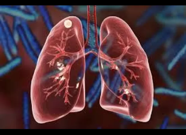 Scare in Ganjam over TB as medicines run low.