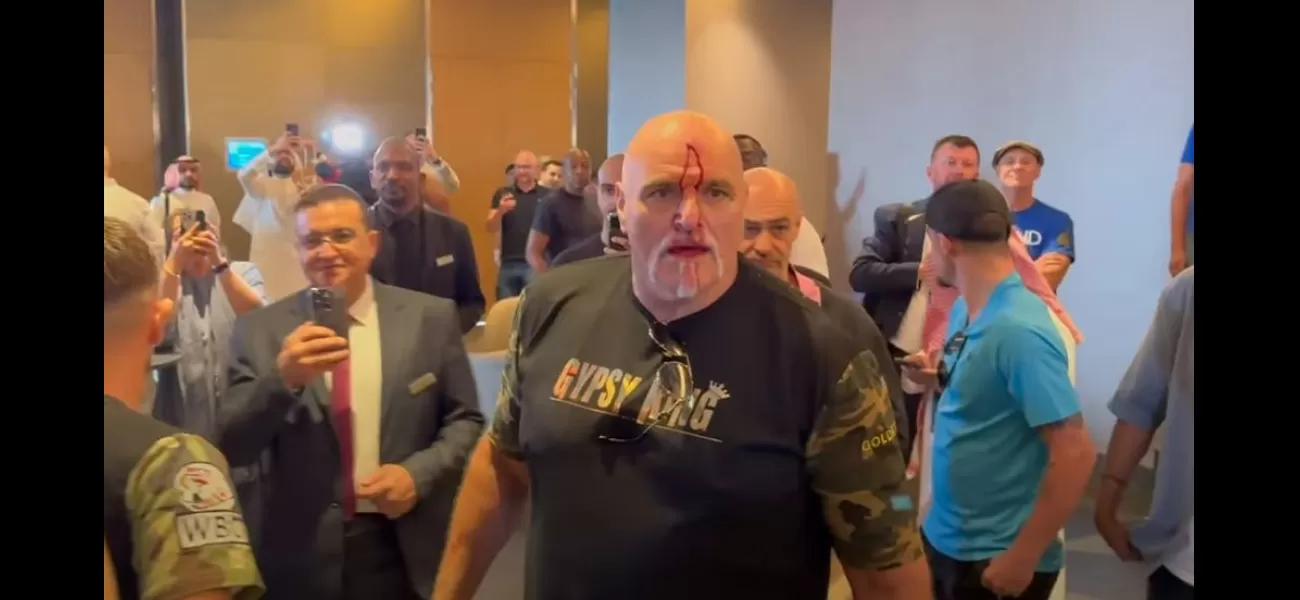 John Fury, father of boxer Tyson Fury, was injured after headbutting a member of Oleksandr Usyk's team.