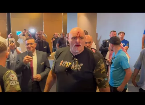 John Fury, father of boxer Tyson Fury, was injured after headbutting a member of Oleksandr Usyk's team.