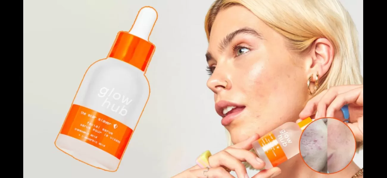People with acne praise this affordable serum, claiming it effectively brightens and clears skin in a matter of days.