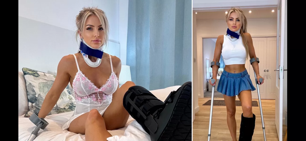 I earn £5,000 monthly by faking leg injuries.