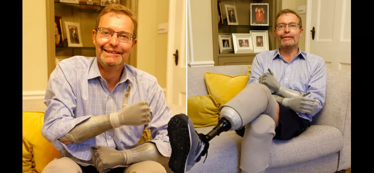 Quadriplegic politician who lost his arms and legs to a severe infection is set to resume his role in government.