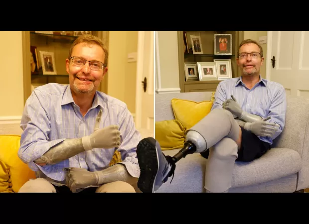 Quadriplegic politician who lost his arms and legs to a severe infection is set to resume his role in government.