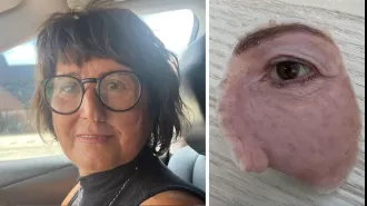 Tracey had her eye removed due to cancer, but her artificial replacement was deemed only for appearance.