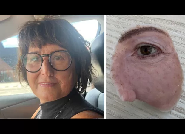 Tracey had her eye removed due to cancer, but her artificial replacement was deemed only for appearance.