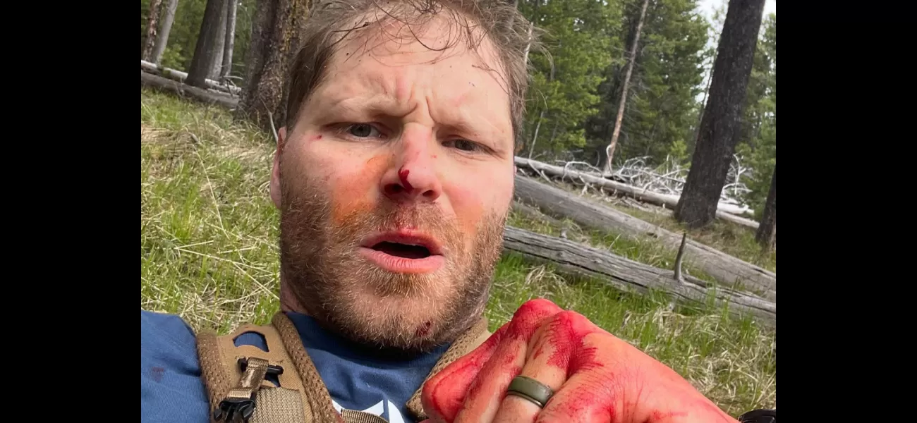 Army veteran shares terrifying story of surviving a bear attack.