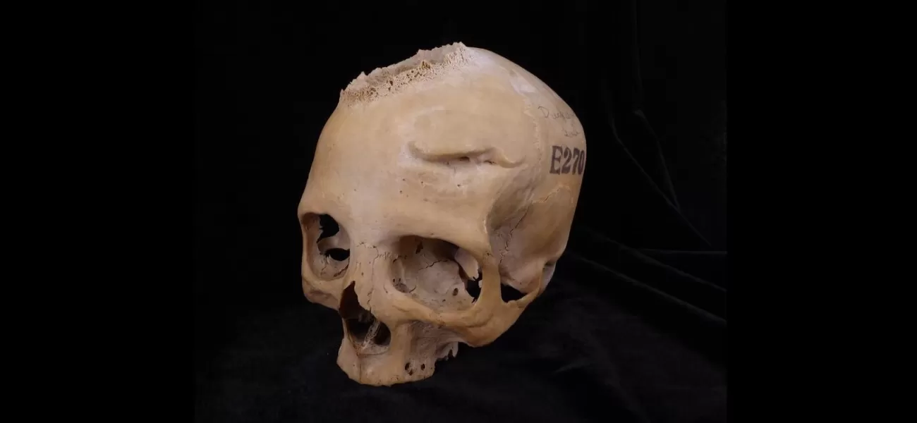 4,000-year-old Egyptian skull may have evidence of ancient cancer treatment.