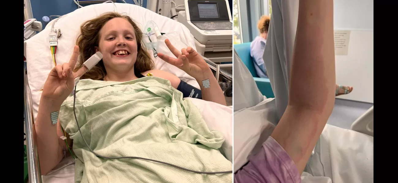 11-year-old girl critically injured by snake bite in UK park.
