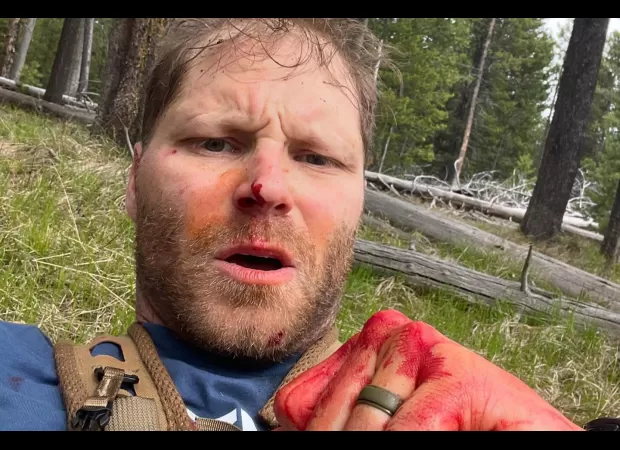 Army veteran shares terrifying story of surviving a bear attack.