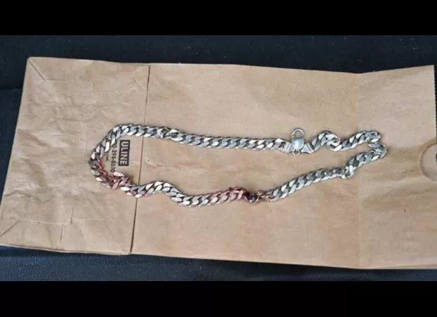 A man's necklace miraculously protects him from a bullet.