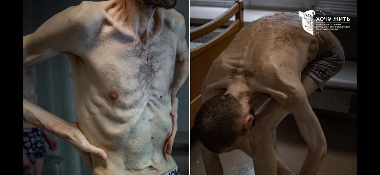 A skinny and sickly guard from Chernobyl reveals the cruelty of Russia's starvation tactics.