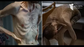 A skinny and sickly guard from Chernobyl reveals the cruelty of Russia's starvation tactics.