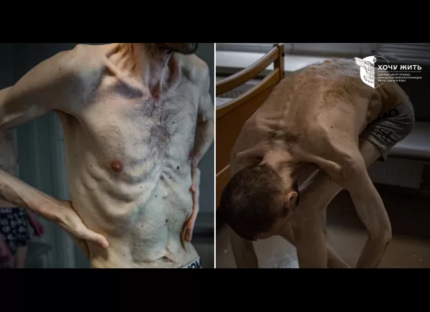 A skinny and sickly guard from Chernobyl reveals the cruelty of Russia's starvation tactics.