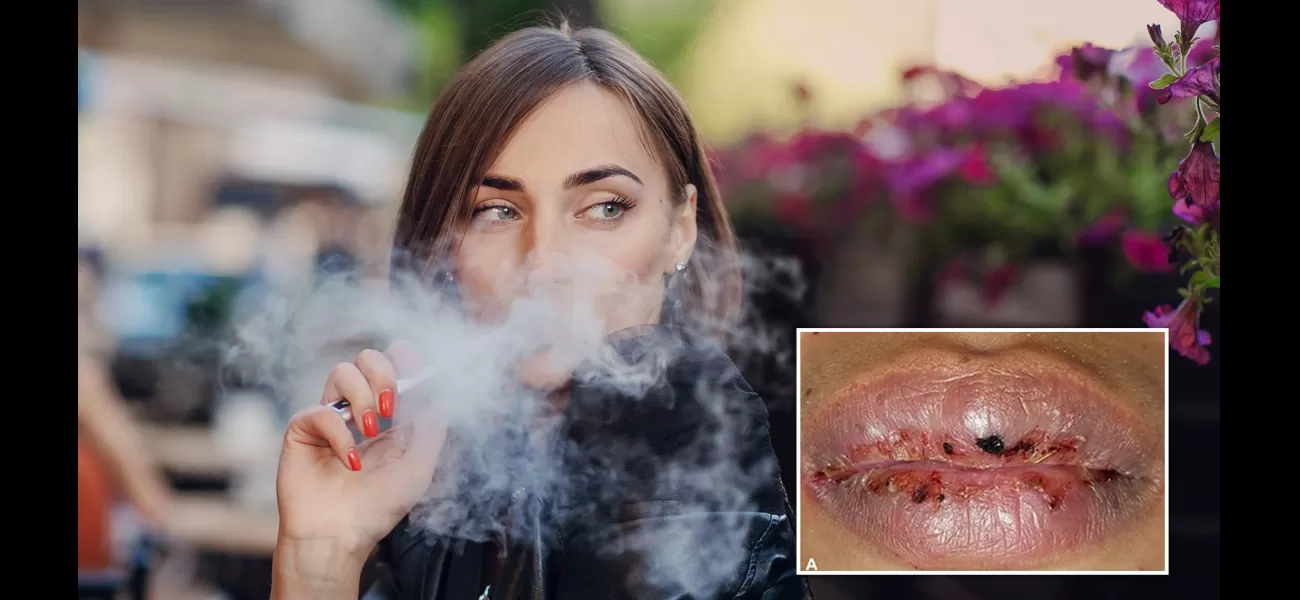 A one-year vaping habit caused severe mouth ulcers that made eating impossible for a woman.