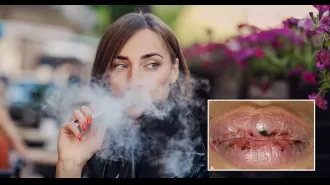 A one-year vaping habit caused severe mouth ulcers that made eating impossible for a woman.