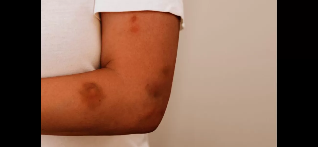 Survivor speaks out on domestic violence as shocking statistics highlight the brutal truths of abusive relationships.
