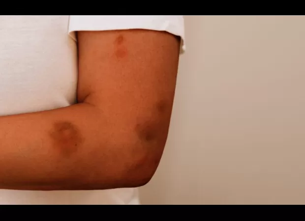 Survivor speaks out on domestic violence as shocking statistics highlight the brutal truths of abusive relationships.