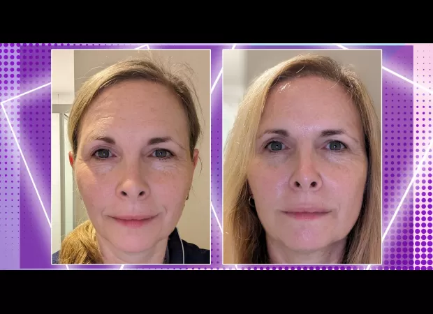 In 6 months, I tested No 7's damage-reversal line to see if it truly delivers amazing results.