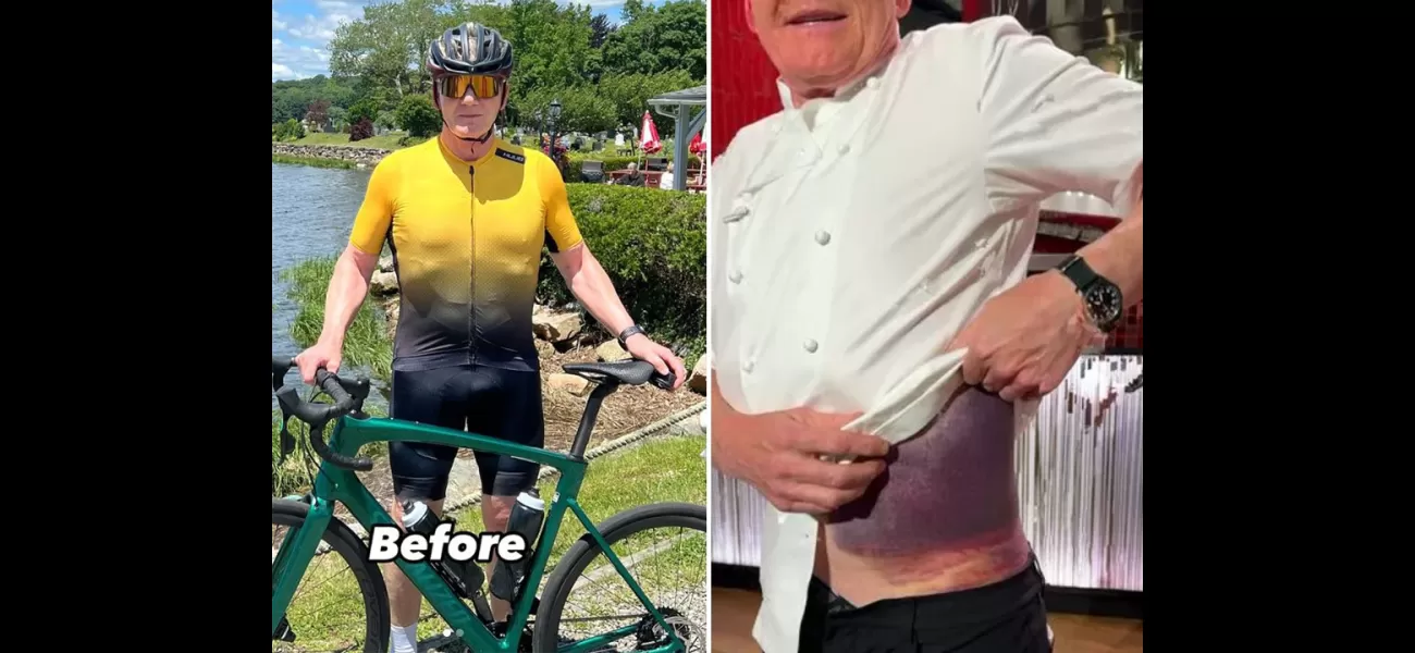 Celebrity chef Gordon Ramsay shares injury from bike accident, grateful to be alive.