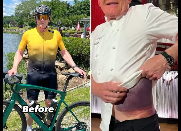 Celebrity chef Gordon Ramsay shares injury from bike accident, grateful to be alive.