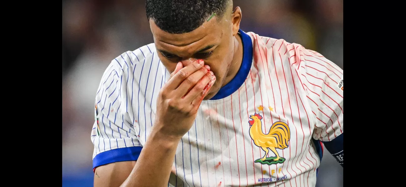 Possible rephrasing: French star Mbappe may be out for the rest of Euro 2024 due to a broken nose and hospitalization.