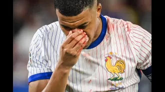 Possible rephrasing: French star Mbappe may be out for the rest of Euro 2024 due to a broken nose and hospitalization.