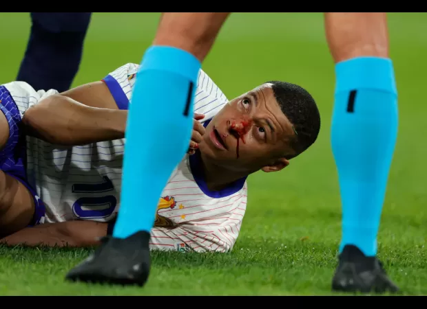 Mbappe injured, France wins against Austria at Euro 2024.