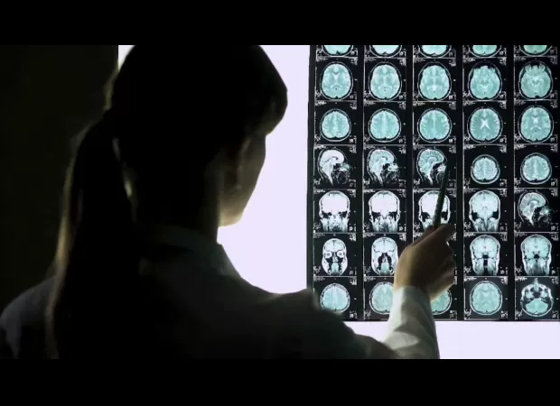 New scanning device may allow paramedics to quickly detect a stroke.