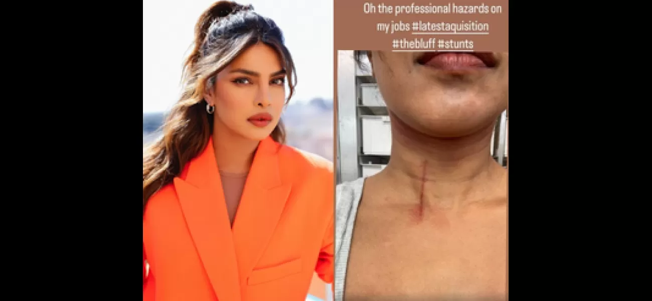 Actress Priyanka Chopra hurt while filming 'The Bluff'