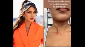 Actress Priyanka Chopra hurt while filming 'The Bluff'