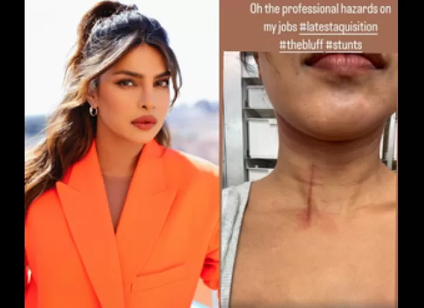 Actress Priyanka Chopra hurt while filming 'The Bluff'