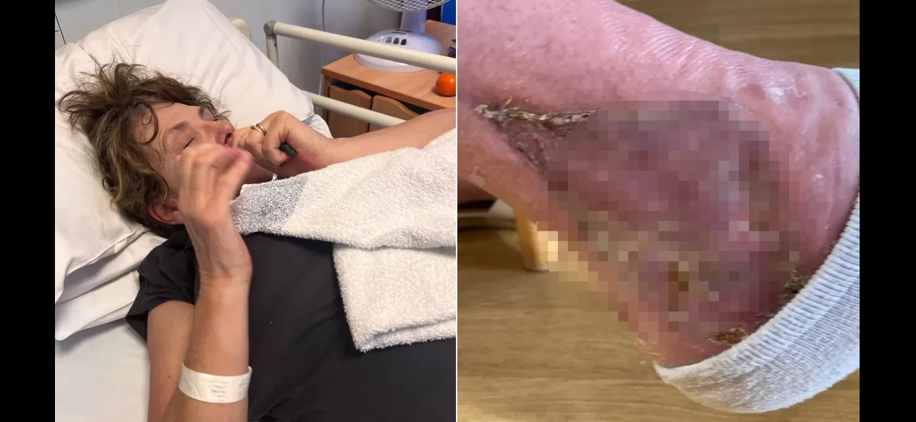 A woman contracted a flesh-eating infection while working in her garden.