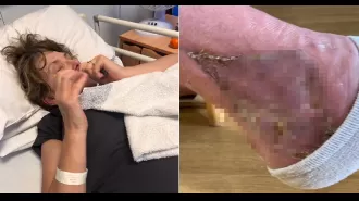 A woman contracted a flesh-eating infection while working in her garden.