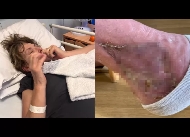 A woman contracted a flesh-eating infection while working in her garden.