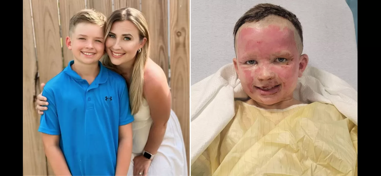 10-year-old boy severely burned after bug spray can explodes in fire pit.