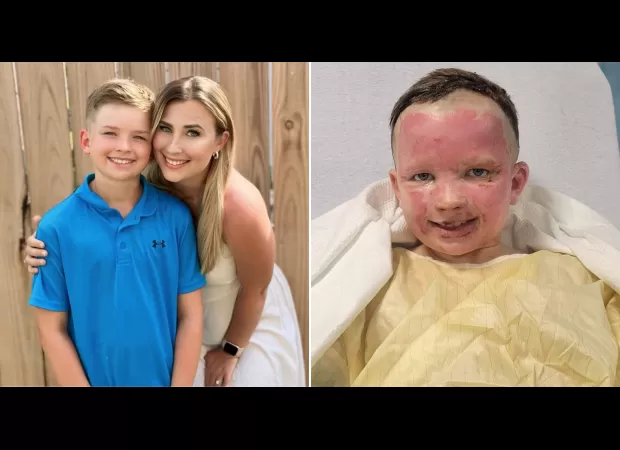 10-year-old boy severely burned after bug spray can explodes in fire pit.