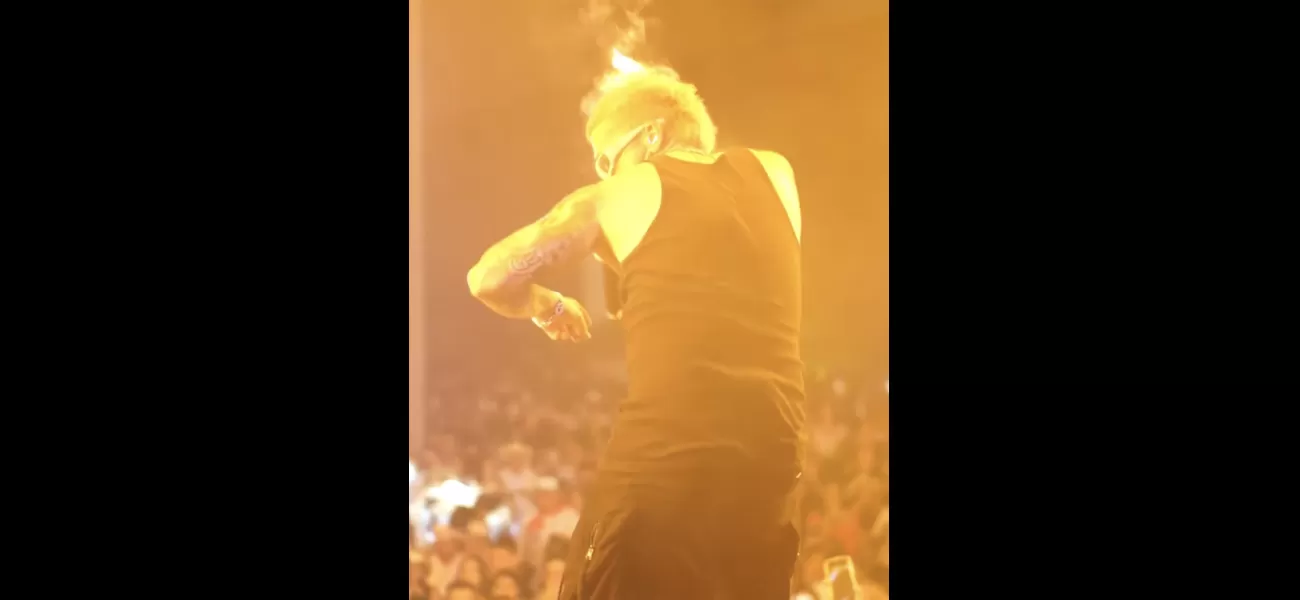 Singer's hair catches fire during performance, causing panic.