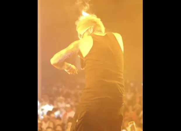 Singer's hair catches fire during performance, causing panic.