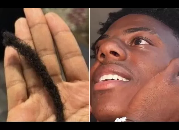 Man sells hair pulled during fight in Norway for $275 on fan merchandise site.