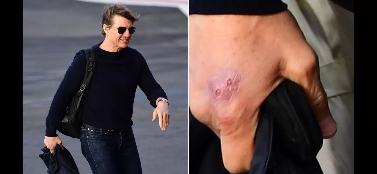 Tom Cruise arrives in London with injury while filming Mission: Impossible.