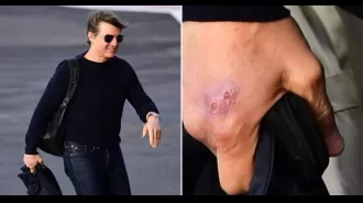 Tom Cruise arrives in London with injury while filming Mission: Impossible.