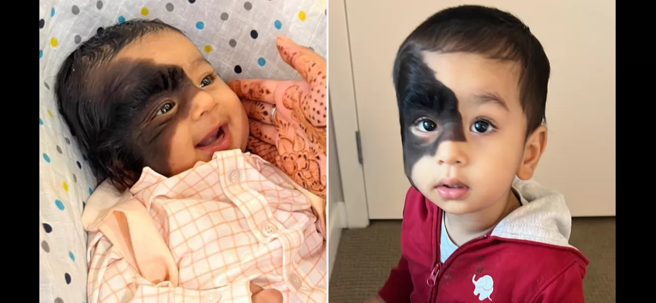 People with unkind intentions ask if I am to blame for my son's appearance.
