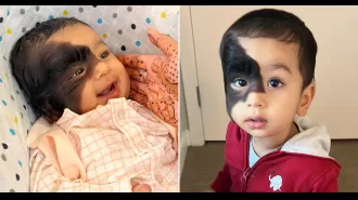 People with unkind intentions ask if I am to blame for my son's appearance.