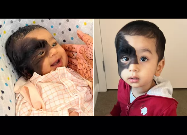 People with unkind intentions ask if I am to blame for my son's appearance.