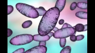 A person in the US has been diagnosed with the bubonic plague.